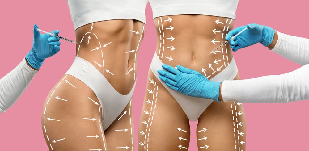 Cosmetic Surgery abroad