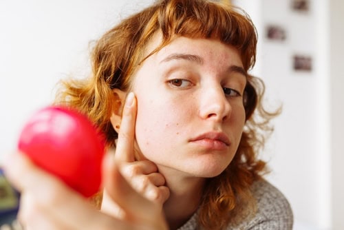 Woman examining redness and breakouts on her skin in the mirror